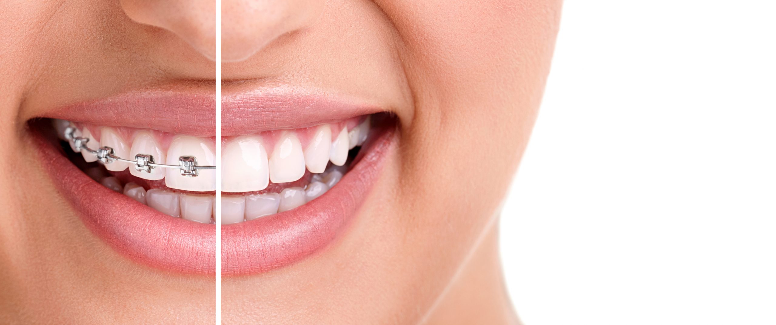 5 Motivos para que Você Contrate o Plano Odontológico Amil